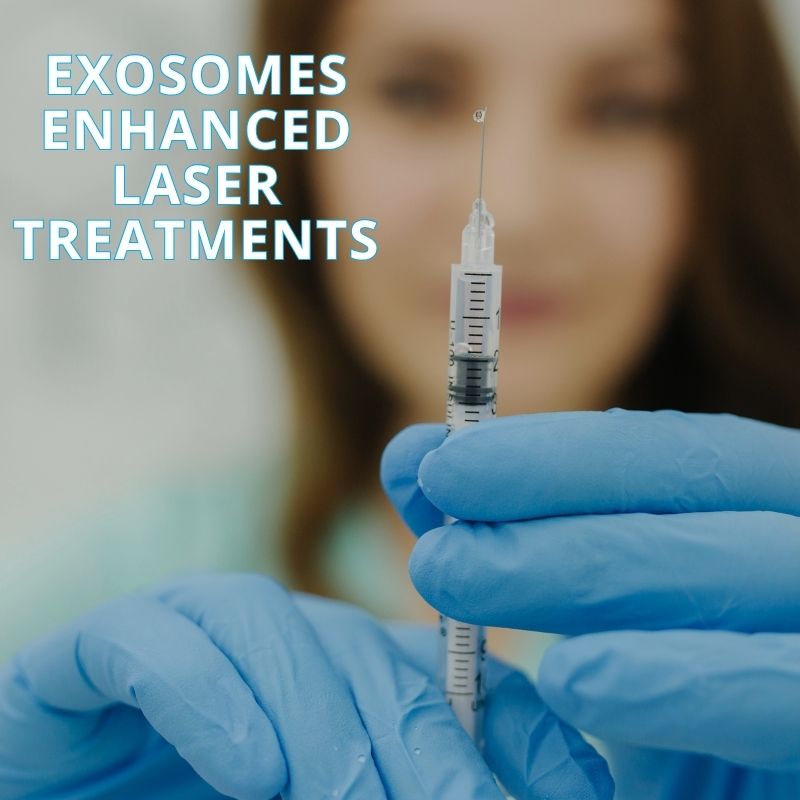 Exosome-enhanced-laser Exosome-enhanced-laser